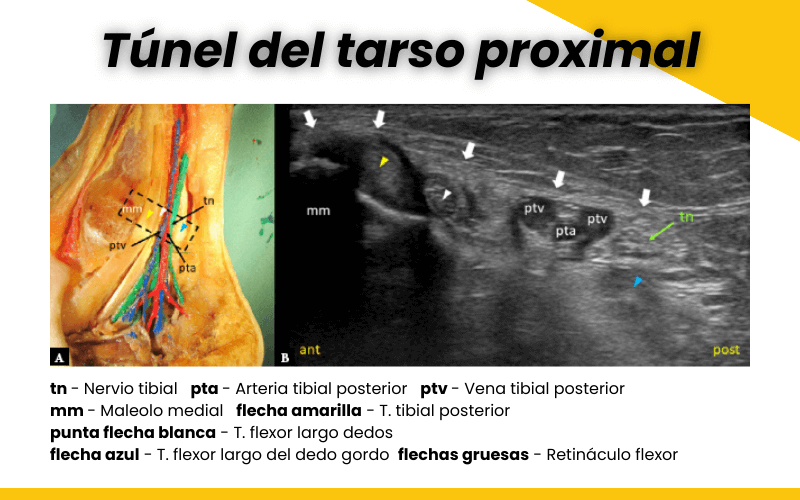 1. Tunel tarso proximal y distal ecografia tempo formacion.png